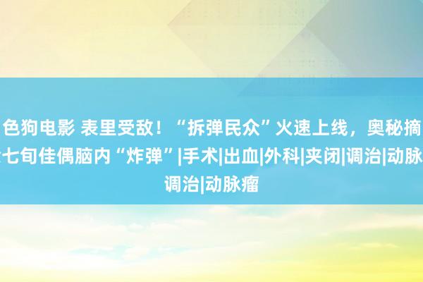 色狗电影 表里受敌！“拆弹民众”火速上线，奥秘摘除七旬佳偶脑内“炸弹”|手术|出血|外科|夹闭|调治|动脉瘤